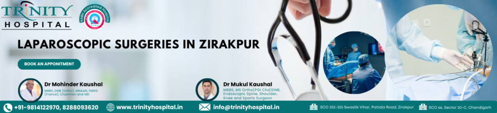 Laparoscopic Surgeries in Zirakpur